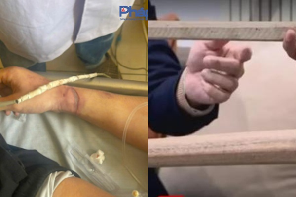 Lời kể đầy uất ức của học viên b:ỏ tr:ốn khỏi ‘địa ngục trần gian’ Hải Hà trong đêm, phanh phui th:ủ đoạn che đậy t:ội á:c